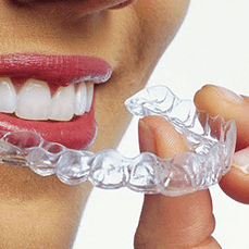 Clear Aligner